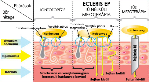 ecleris-ep-tunelkulimezoterapia